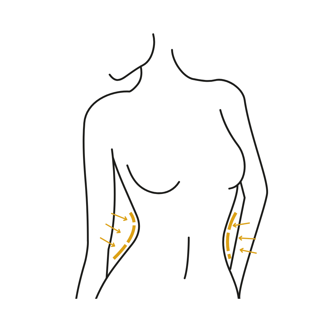 Woman's body illustration highlighting the location of the Body contouring surgery