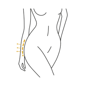 Woman's body illustration highlighting the location of the Buttock surgery
