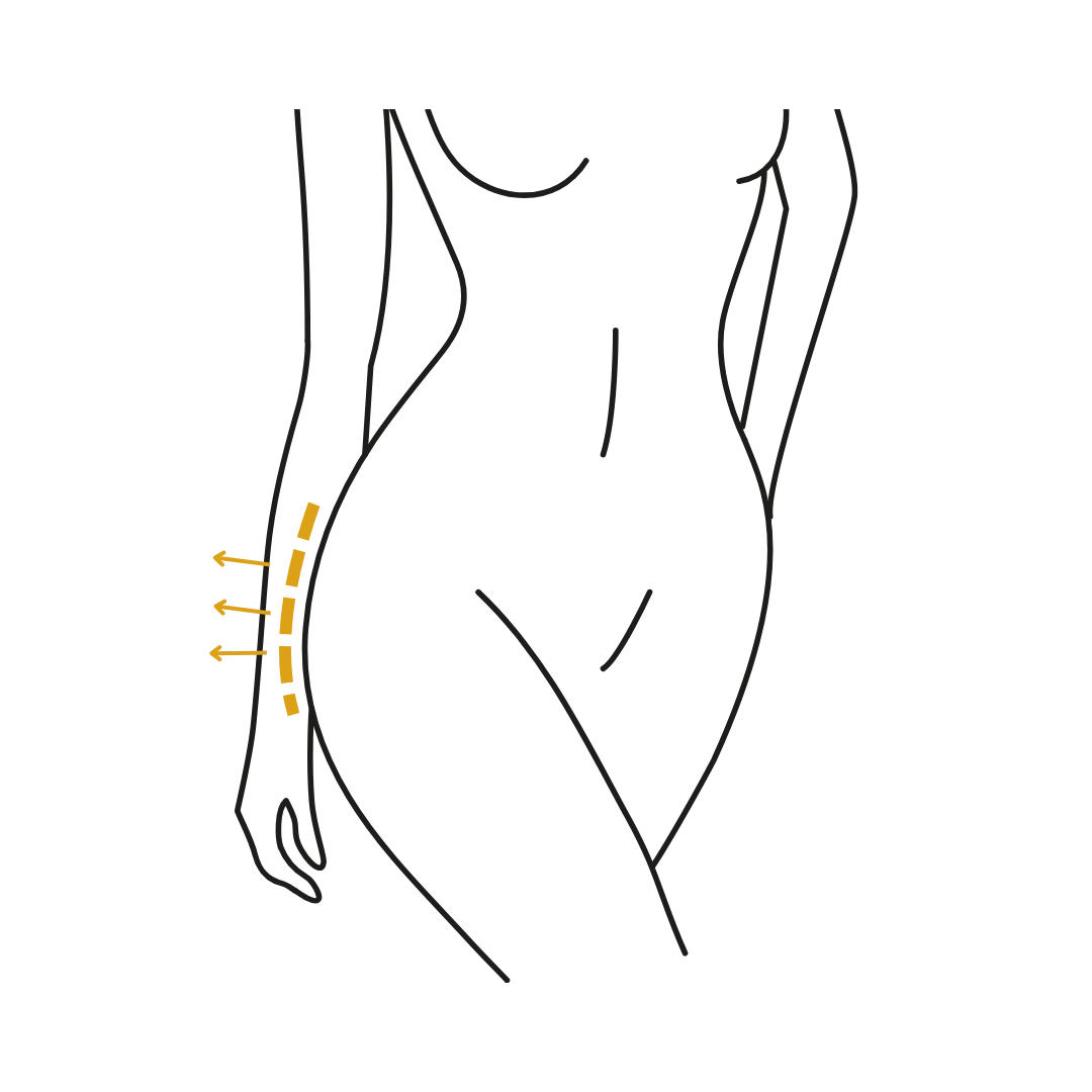 Woman's body illustration highlighting the location of the Buttock surgery